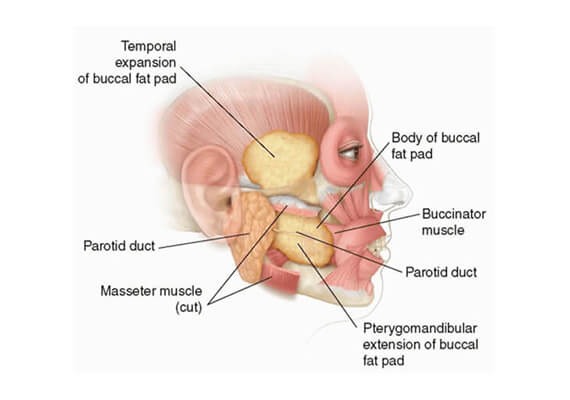 Buccal Pad Fat Removal Surgery in Gurgaon