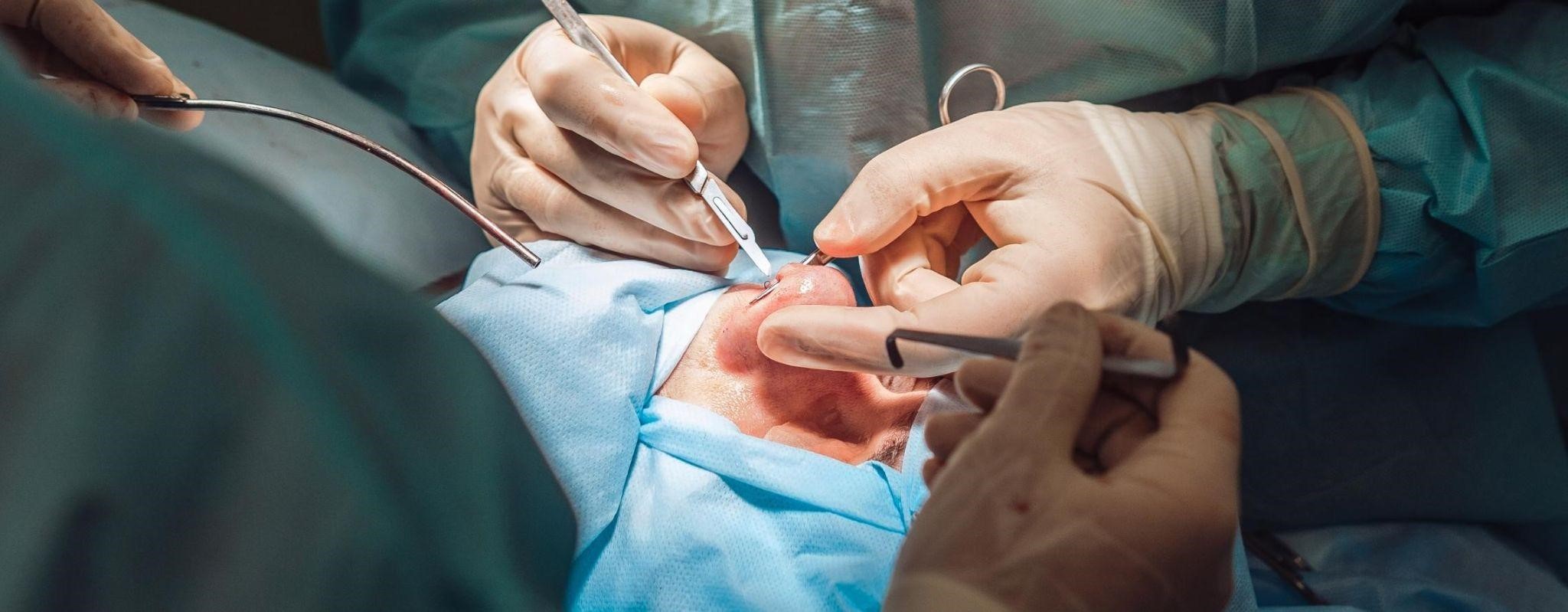 rhinoplasty surgery in Gurgaon