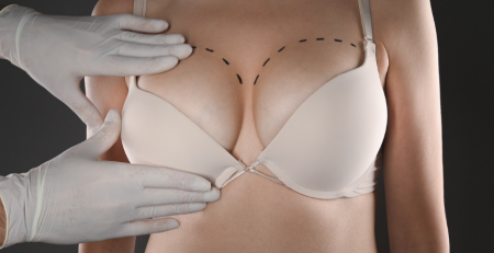 Breast Augmentation surgery in India