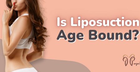 Liposuction Age